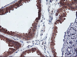 UCHL1 Antibody in Immunohistochemistry (Paraffin) (IHC (P))