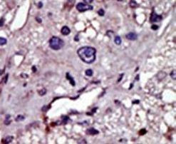 CMPK1 Antibody in Immunohistochemistry (IHC)