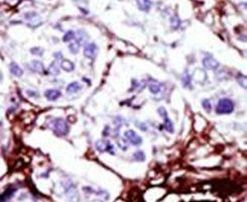 CMPK1 Antibody in Immunohistochemistry (IHC)