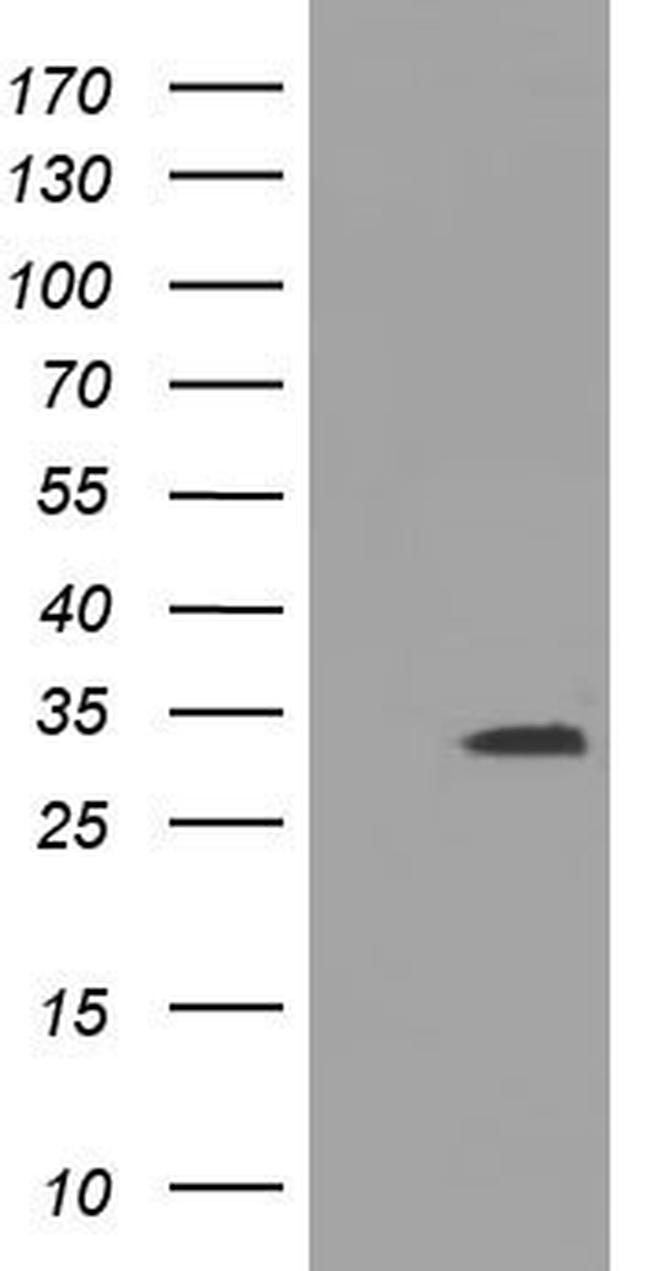 UCK1 Antibody in Western Blot (WB)