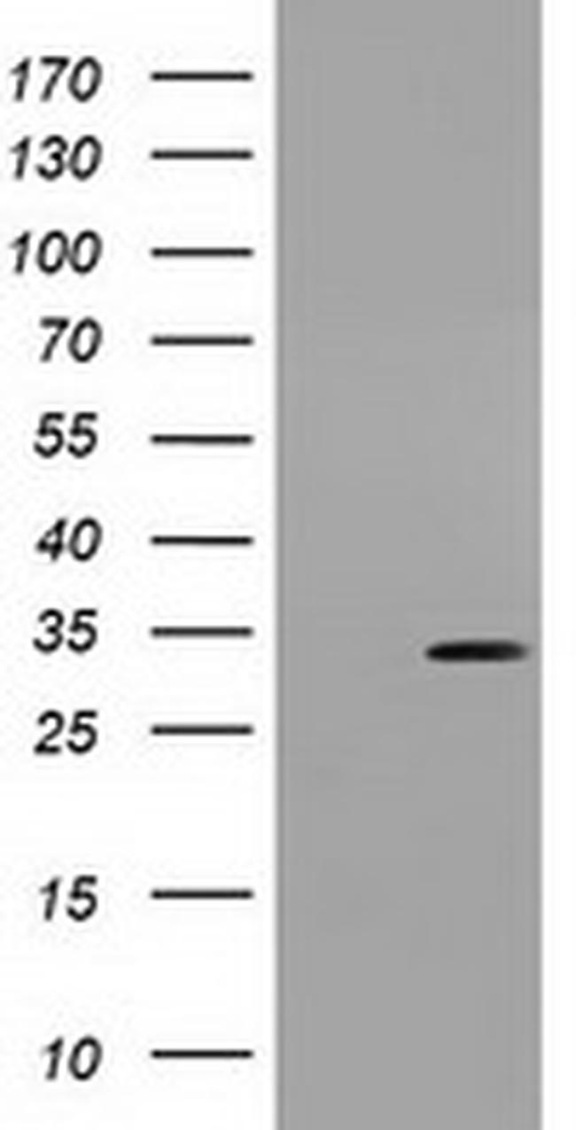UCK1 Antibody in Western Blot (WB)