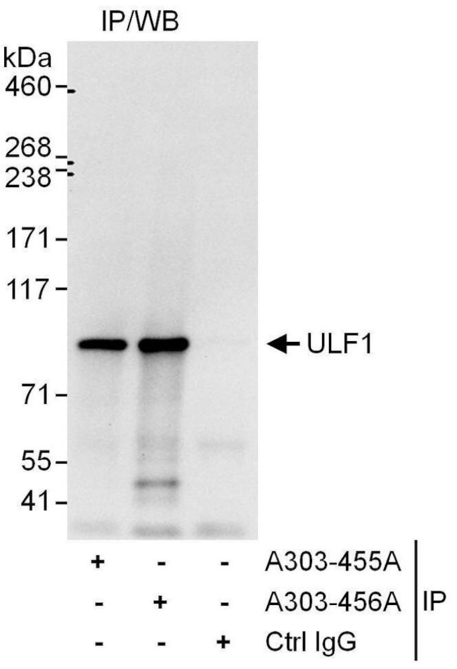 UFL1 Polyclonal Antibody (A303-455A)