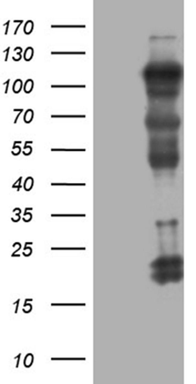 UHRF2 Antibody in Western Blot (WB)