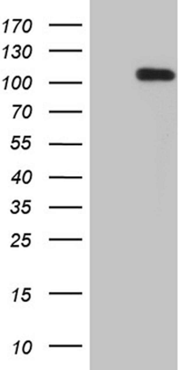UHRF2 Antibody in Western Blot (WB)