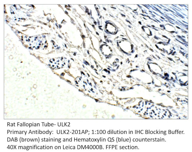 ULK2 Antibody in Immunohistochemistry (IHC)