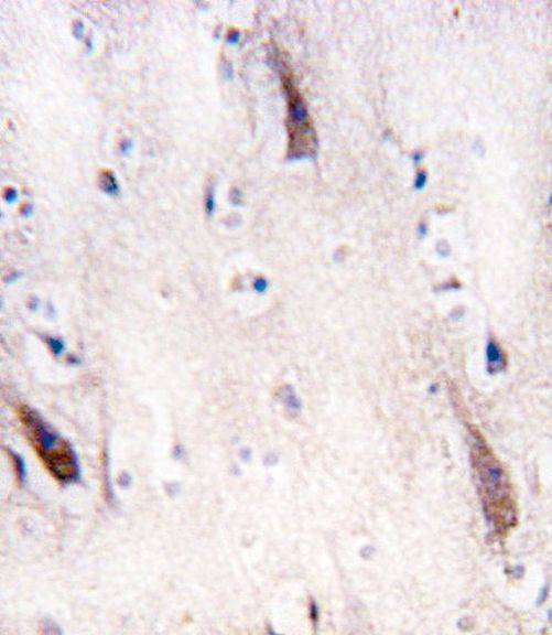 ULK2 Antibody in Immunohistochemistry (IHC)