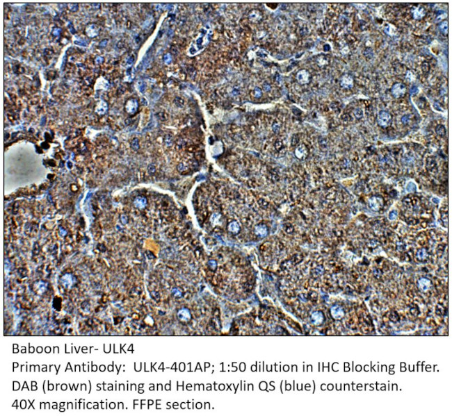 ULK4 Antibody in Immunohistochemistry (IHC)
