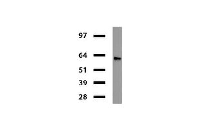 Desmin Antibody in Western Blot (WB)