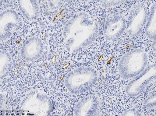 VWF Antibody in Immunohistochemistry (Paraffin) (IHC (P))