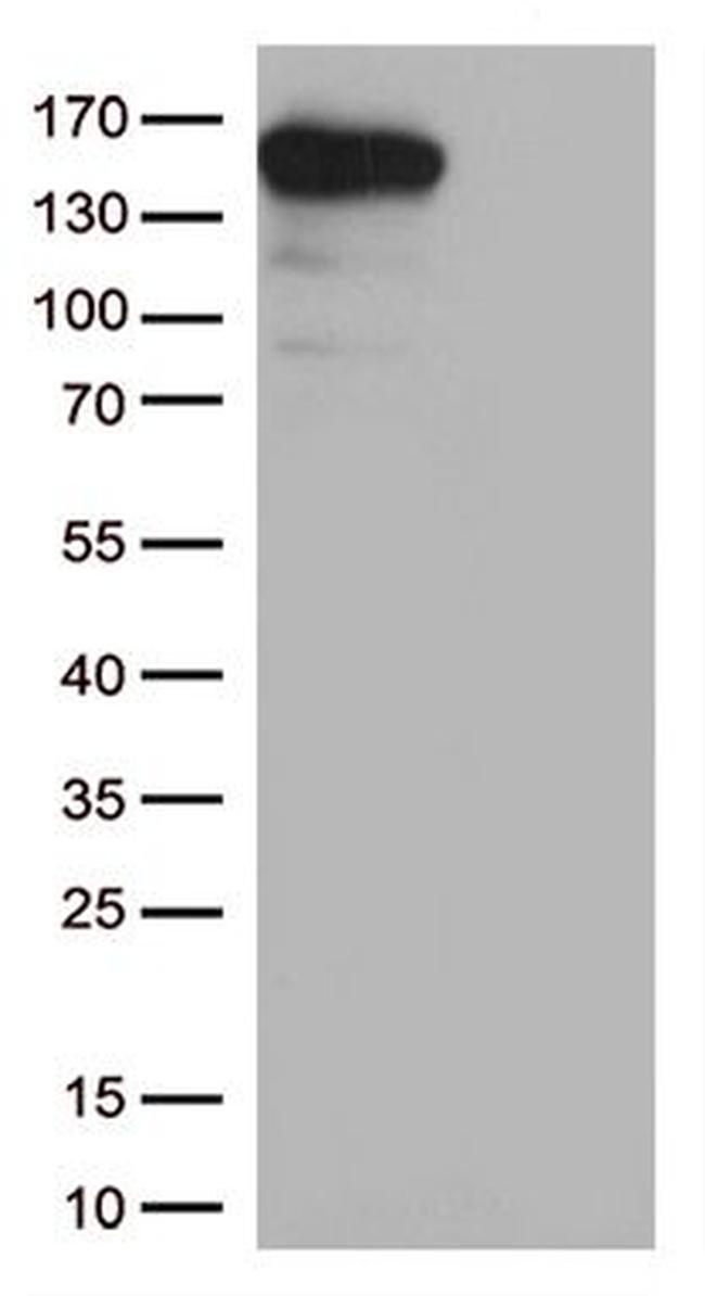 CPS1 Antibody in Western Blot (WB)