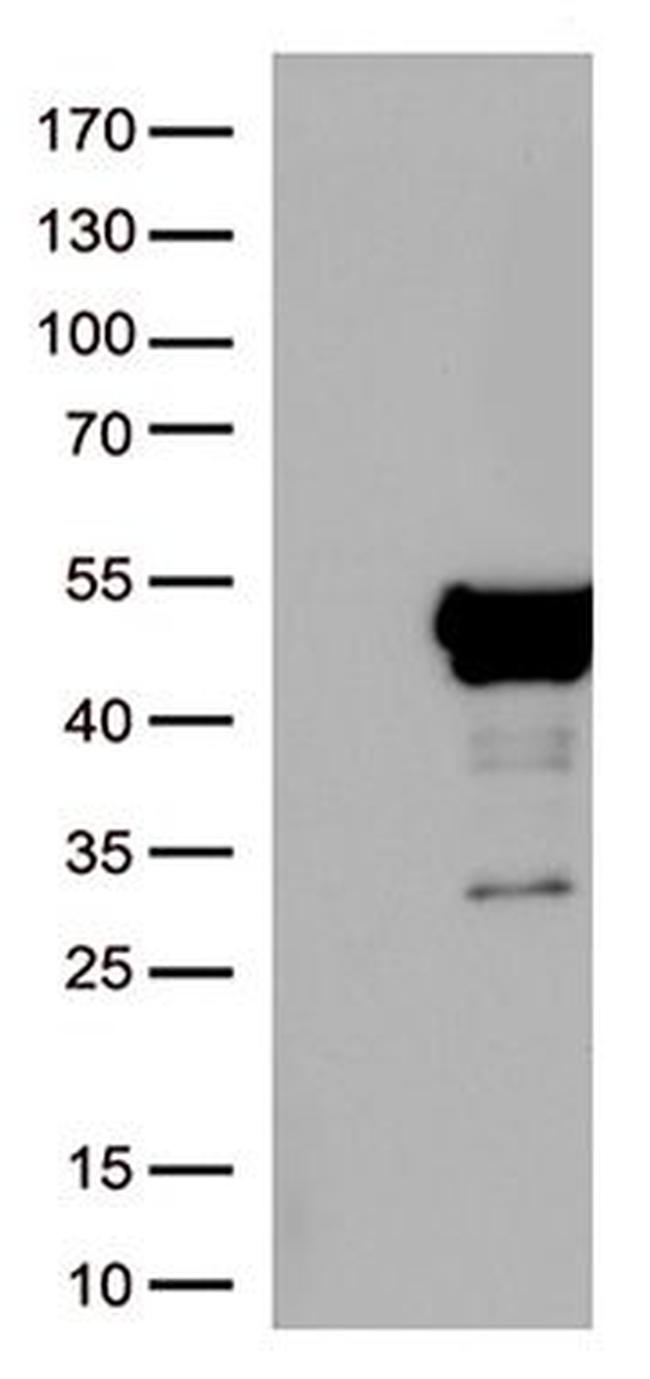 NSE (ENO2) Antibody in Western Blot (WB)