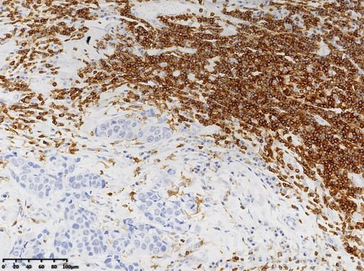CD45 (PTPRC) Antibody in Immunohistochemistry (Paraffin) (IHC (P))