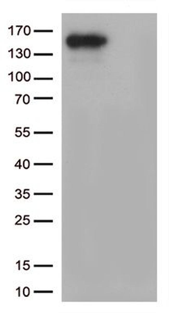 CPS1 Antibody in Western Blot (WB)