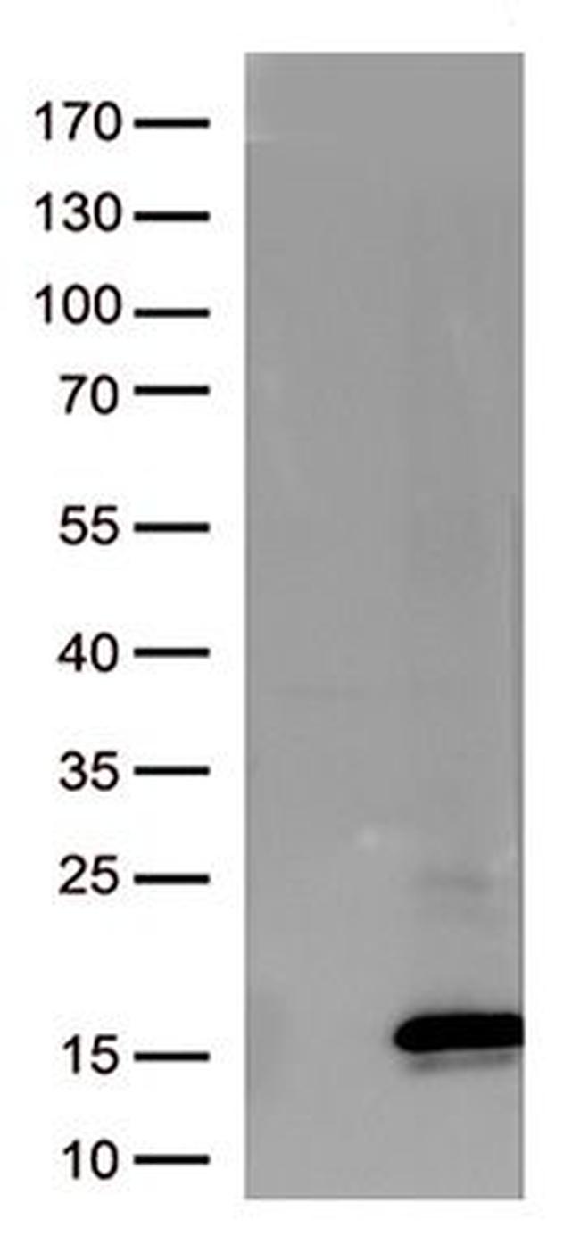 Melan A (MLANA) Antibody in Western Blot (WB)