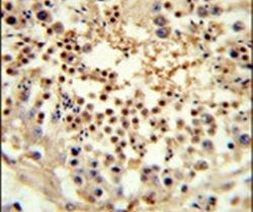UNC119 Antibody in Immunohistochemistry (IHC)