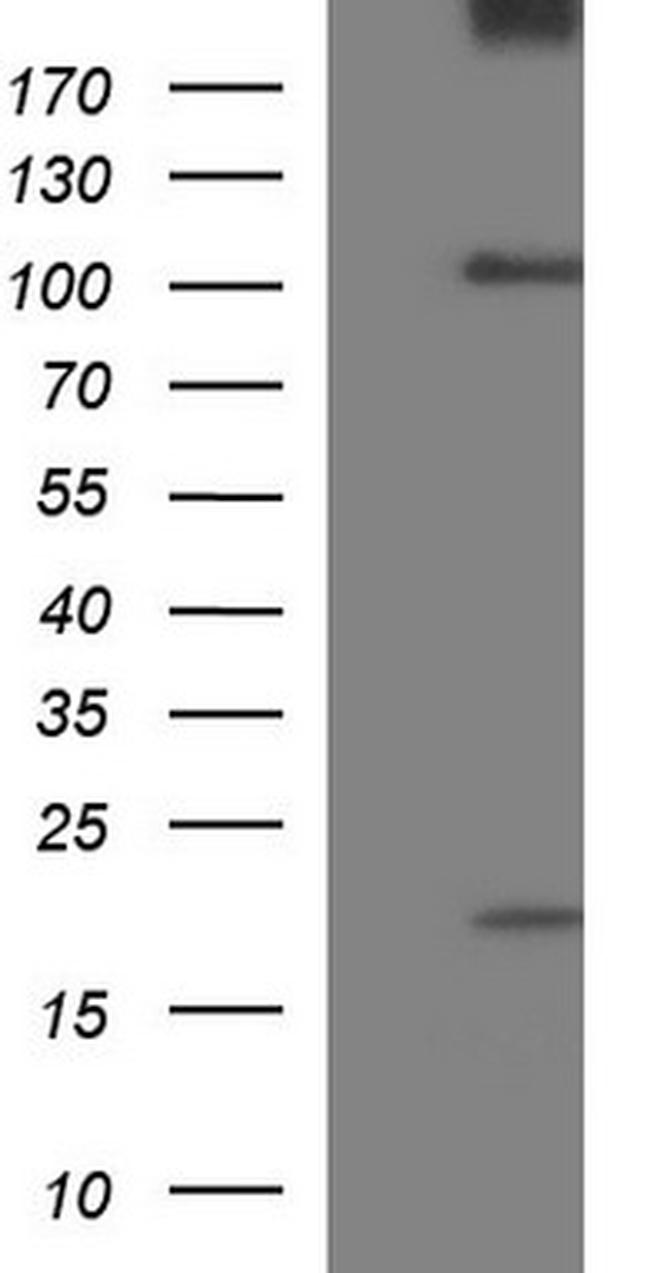 UNC13D Antibody in Western Blot (WB)