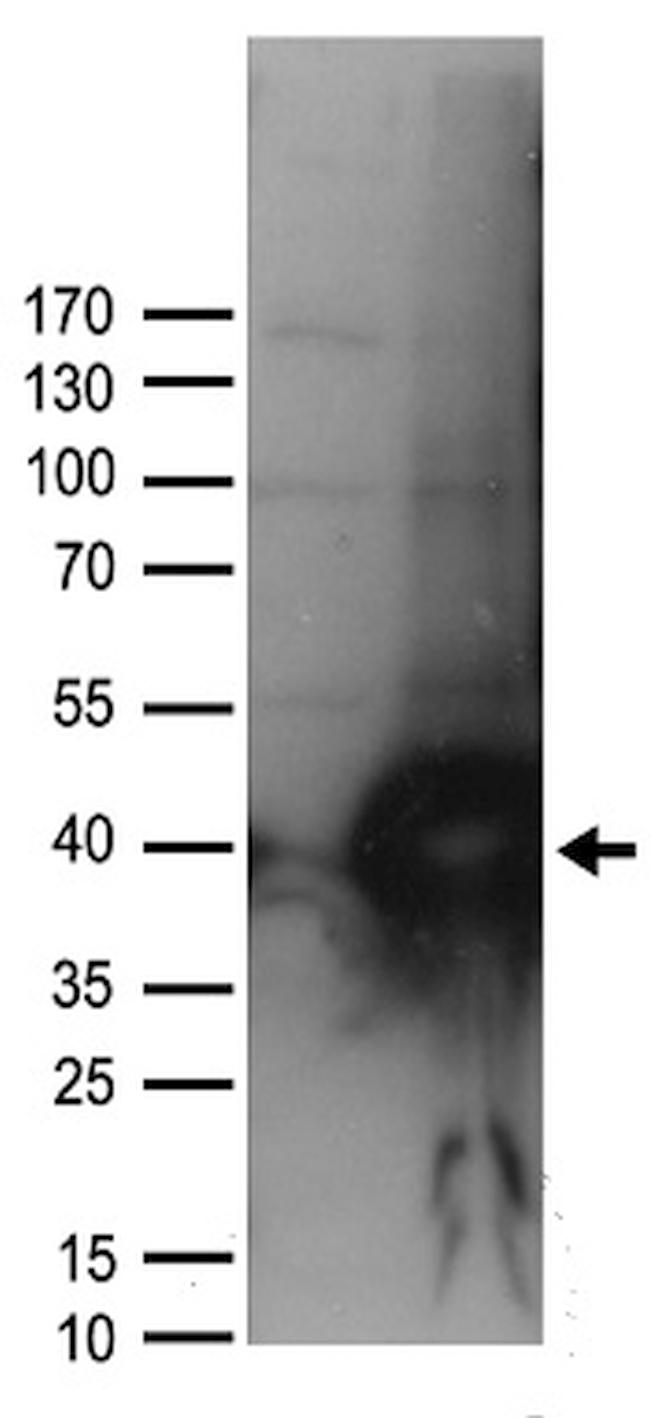 UNG Antibody in Western Blot (WB)