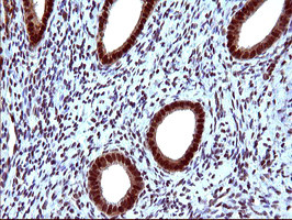UPRT Antibody in Immunohistochemistry (Paraffin) (IHC (P))