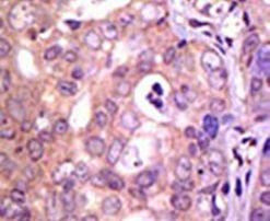 USP1 Antibody in Immunohistochemistry (IHC)