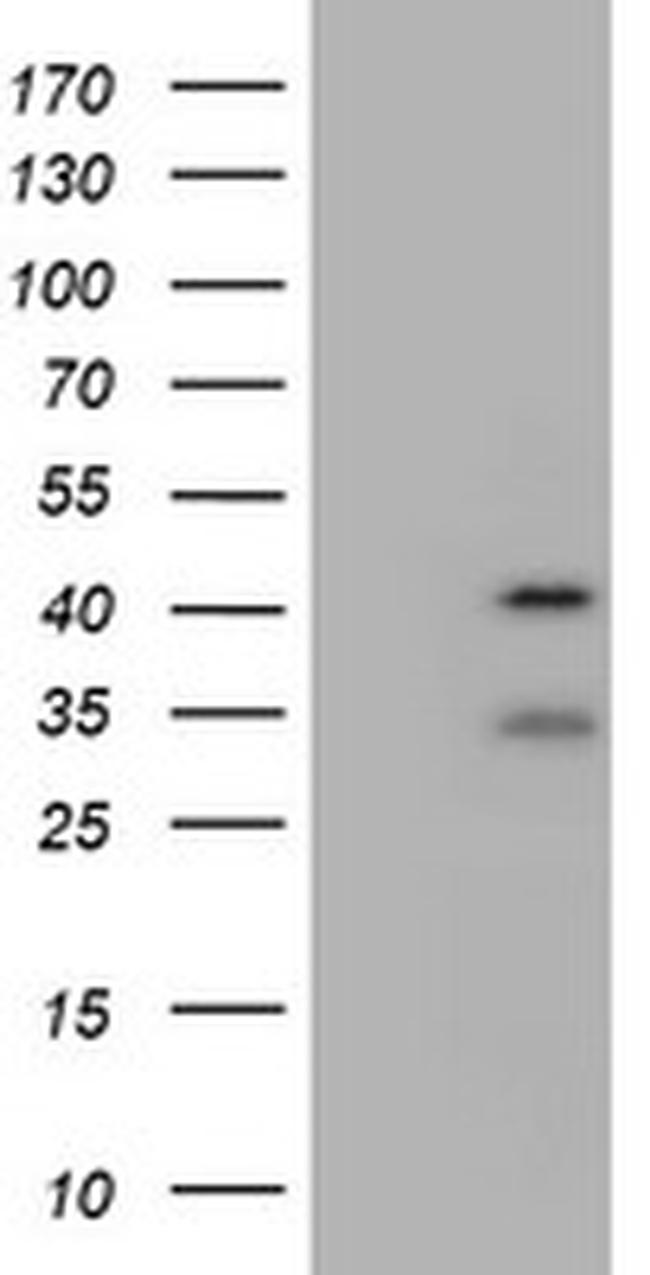 USP12 Antibody in Western Blot (WB)