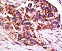 USP13 Antibody in Immunohistochemistry (IHC)