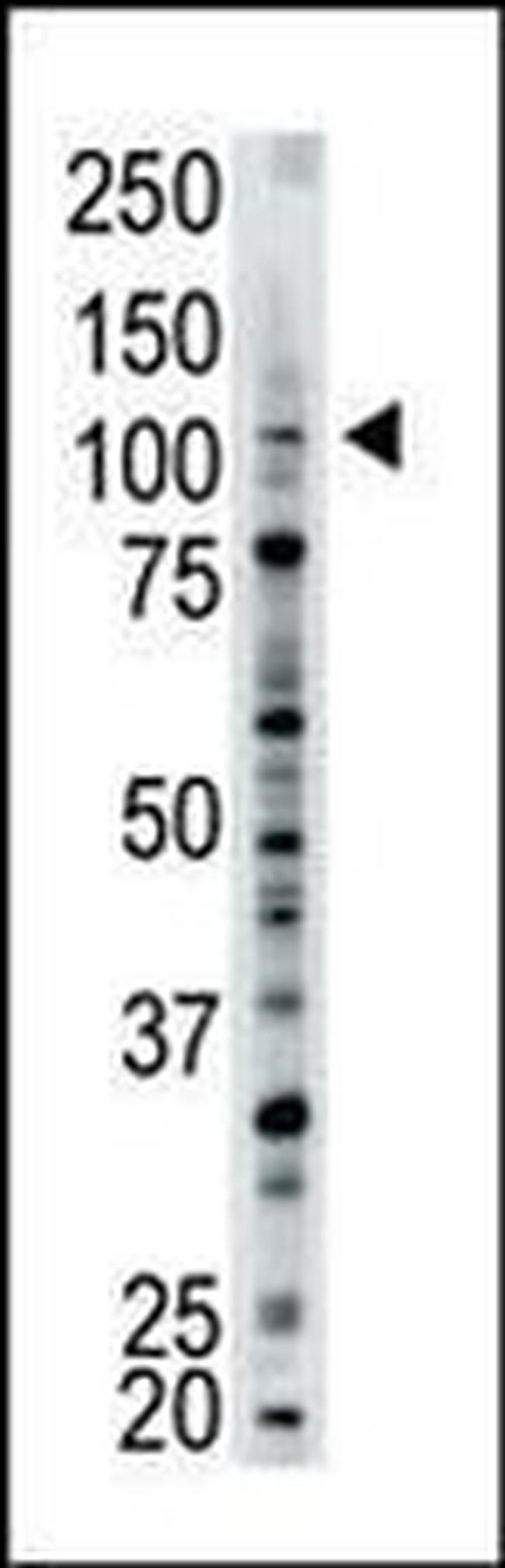 USP15 Antibody in Western Blot (WB)