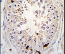 USP2 Antibody in Immunohistochemistry (IHC)