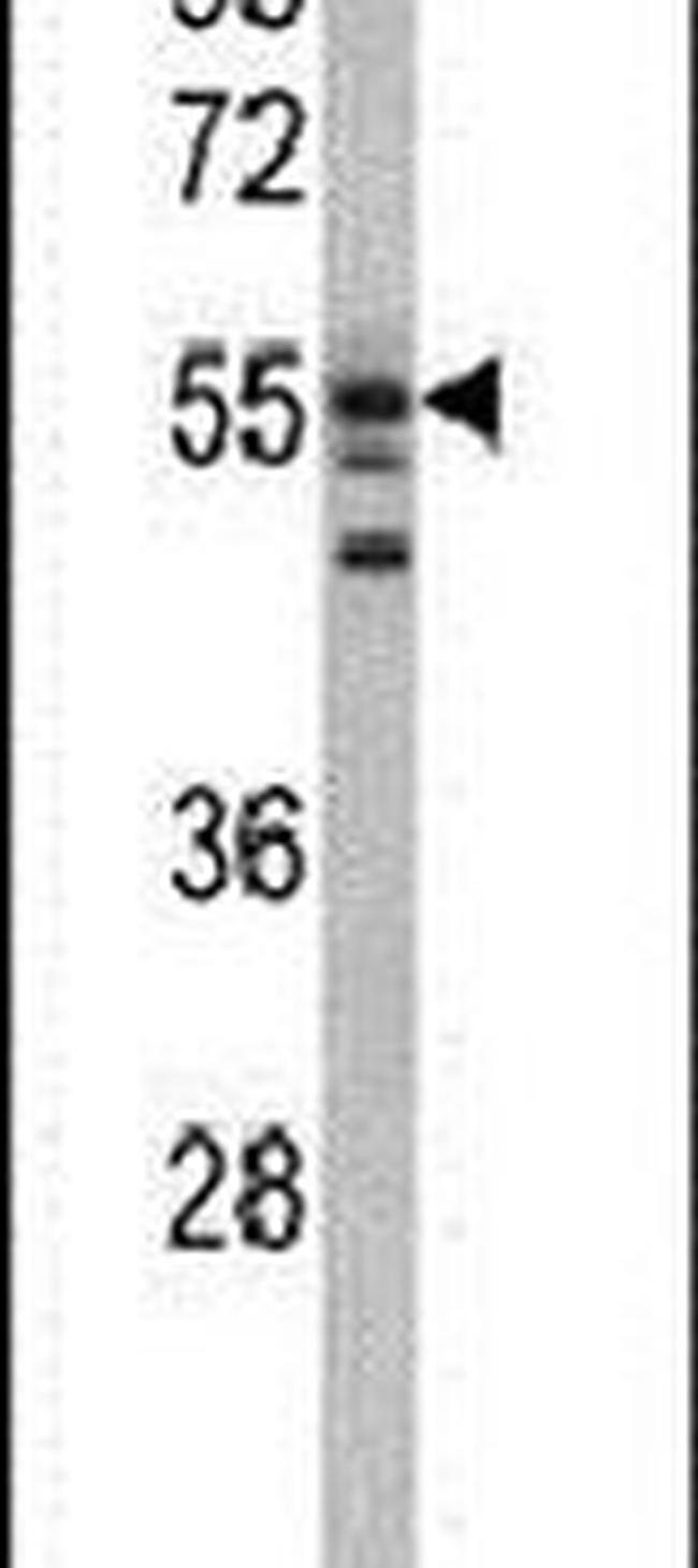 USP22 Antibody in Western Blot (WB)