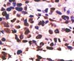 USP25 Antibody in Immunohistochemistry (IHC)