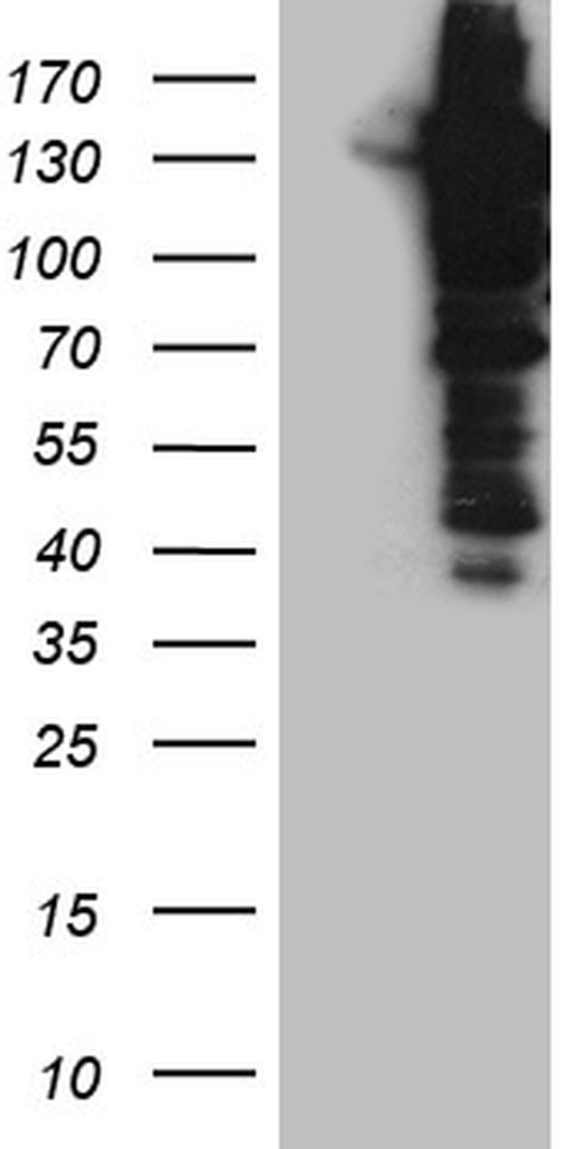 USP25 Antibody in Western Blot (WB)