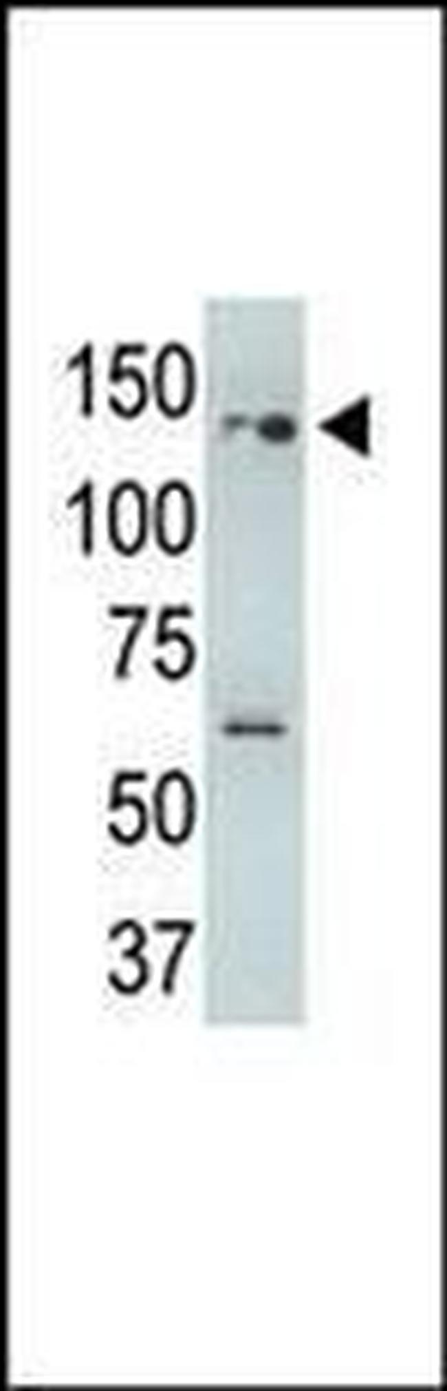 USP25 Antibody in Western Blot (WB)