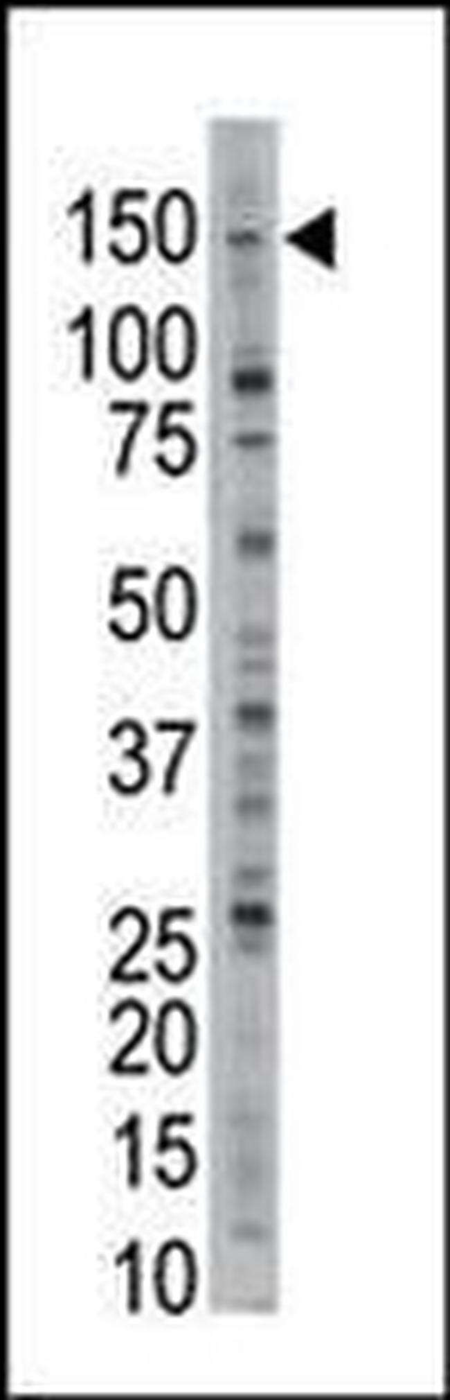 USP28 Antibody in Western Blot (WB)