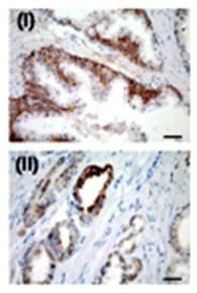 USP2 Antibody in Immunohistochemistry (IHC)