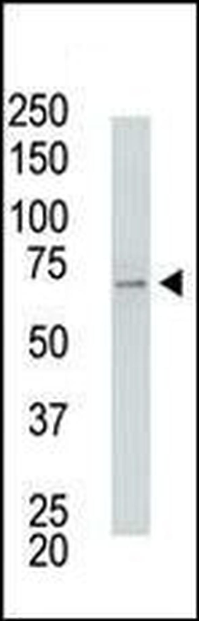 USP2 Antibody in Western Blot (WB)