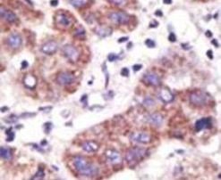 USP3 Antibody in Immunohistochemistry (IHC)