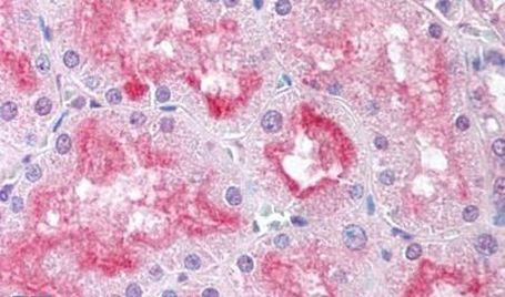 USP33 Antibody in Immunohistochemistry (Paraffin) (IHC (P))
