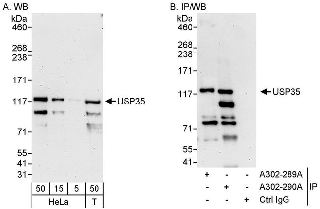 USP35 Antibody in Western Blot (WB)