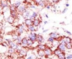 USP4 Antibody in Immunohistochemistry (IHC)