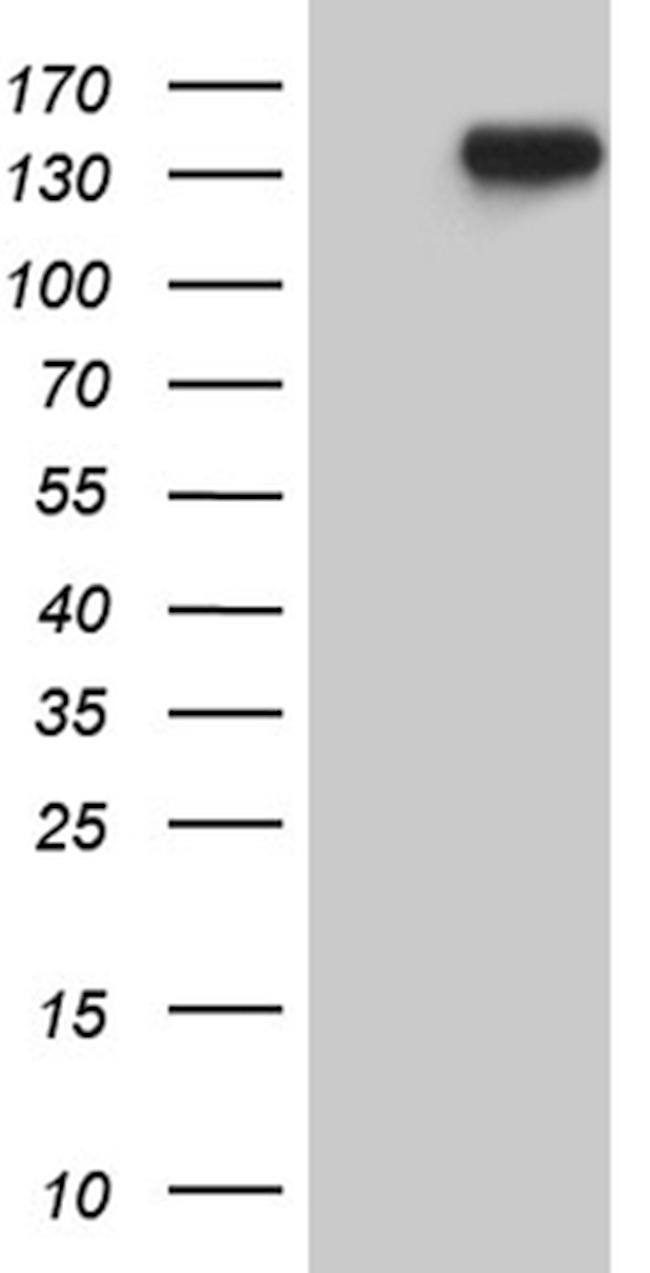 USP40 Antibody in Western Blot (WB)