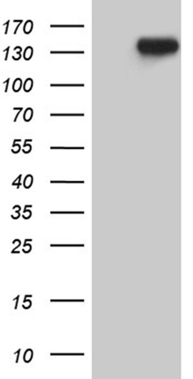 USP40 Antibody in Western Blot (WB)