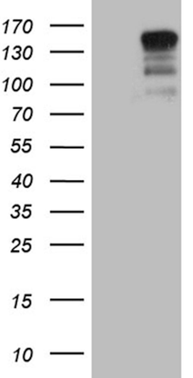 USP40 Antibody in Western Blot (WB)