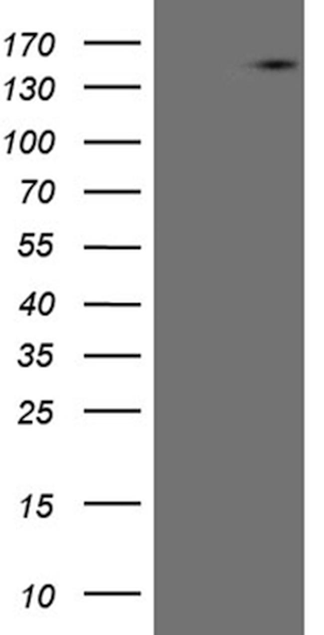 USP40 Antibody in Western Blot (WB)
