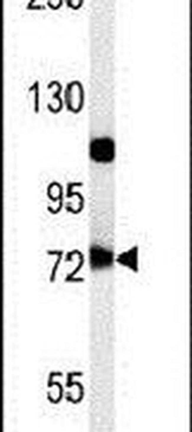 USP49 Antibody in Western Blot (WB)