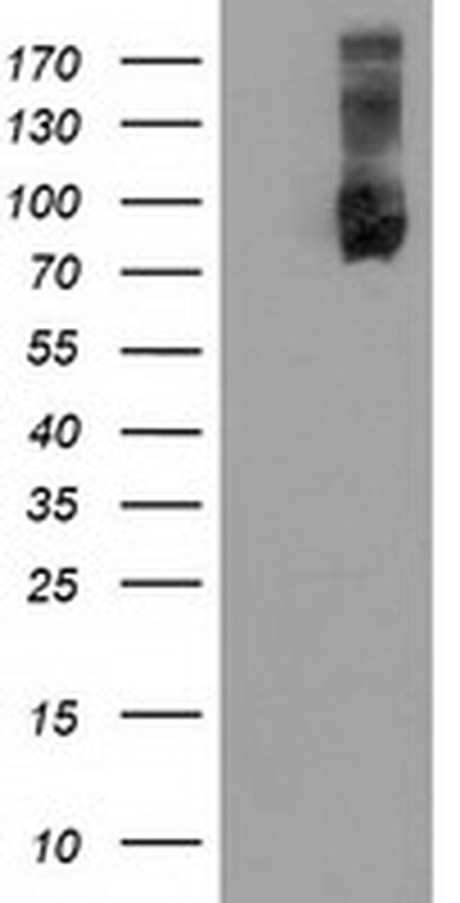 USP5 Antibody in Western Blot (WB)