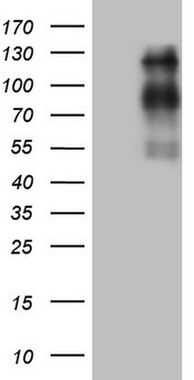 USP53 Antibody in Western Blot (WB)