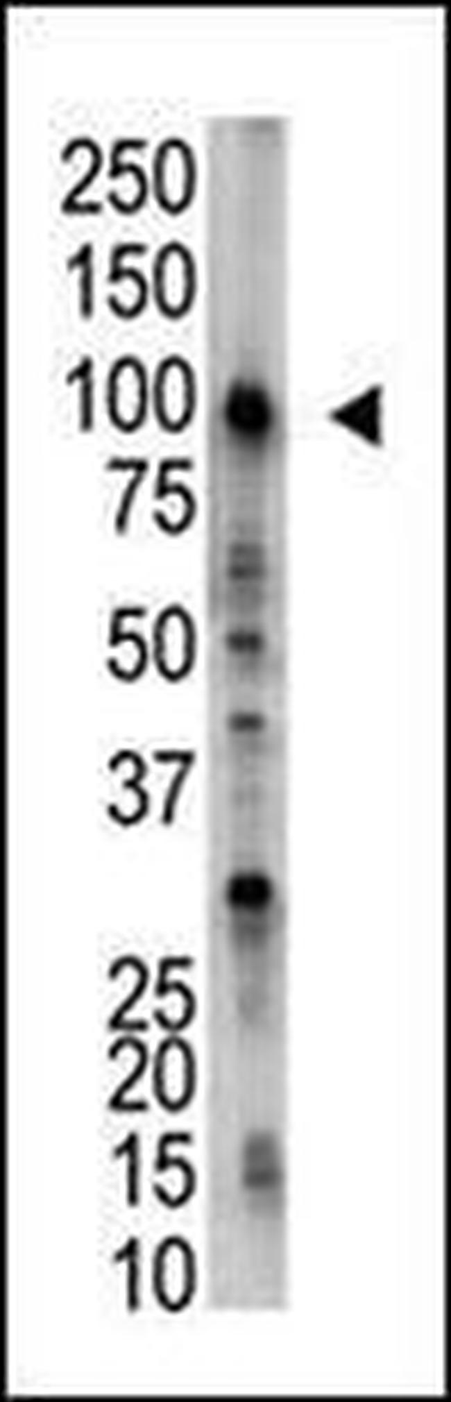 USP5 Antibody in Western Blot (WB)
