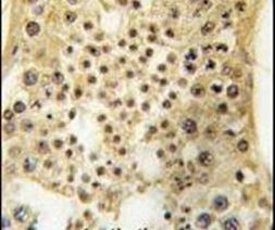 USP7 Antibody in Immunohistochemistry (IHC)