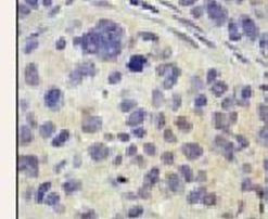USP8 Antibody in Immunohistochemistry (IHC)