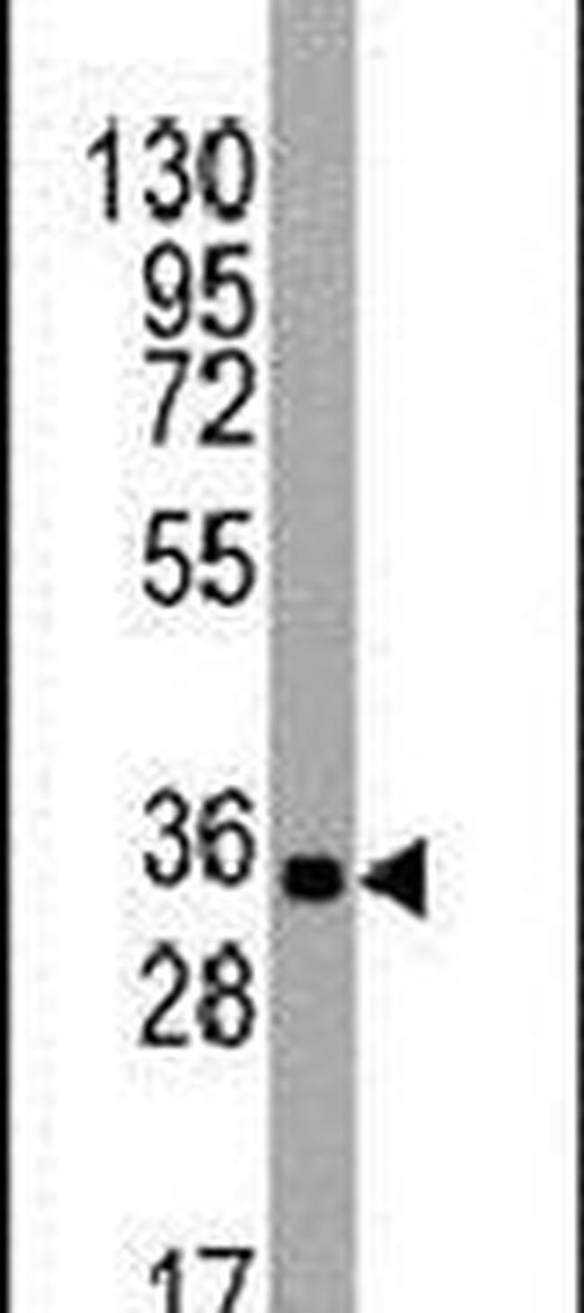 UTF1 Antibody in Western Blot (WB)