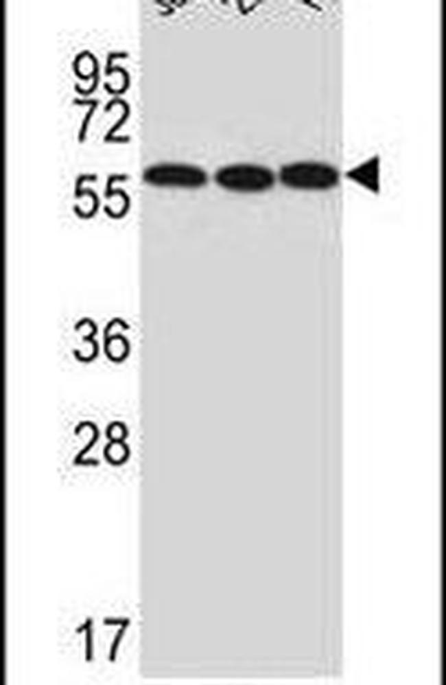 UTP6 Antibody in Western Blot (WB)